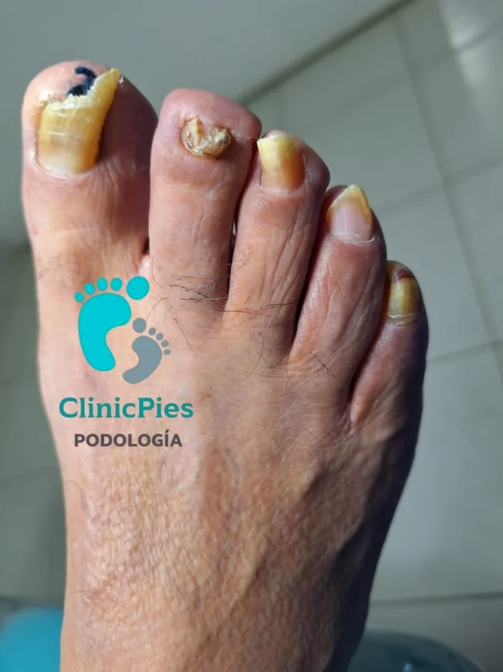 ClinicPies Podología