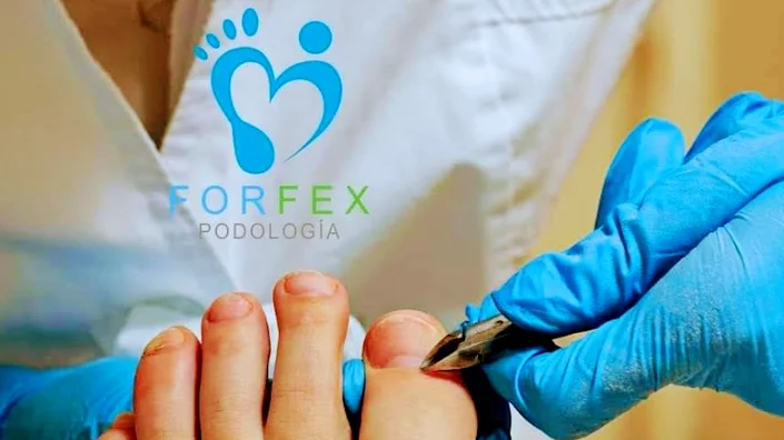 Podología Bogotá | Uñas encarnadas | Forfex