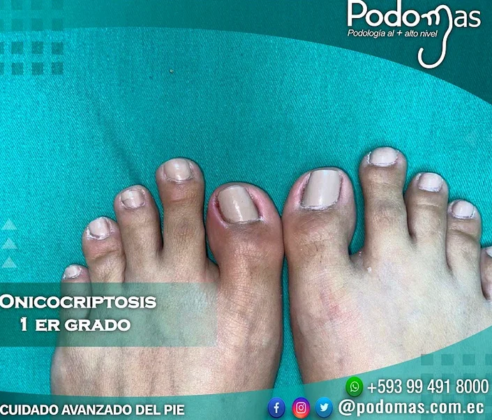 Podología Clínica Podomas