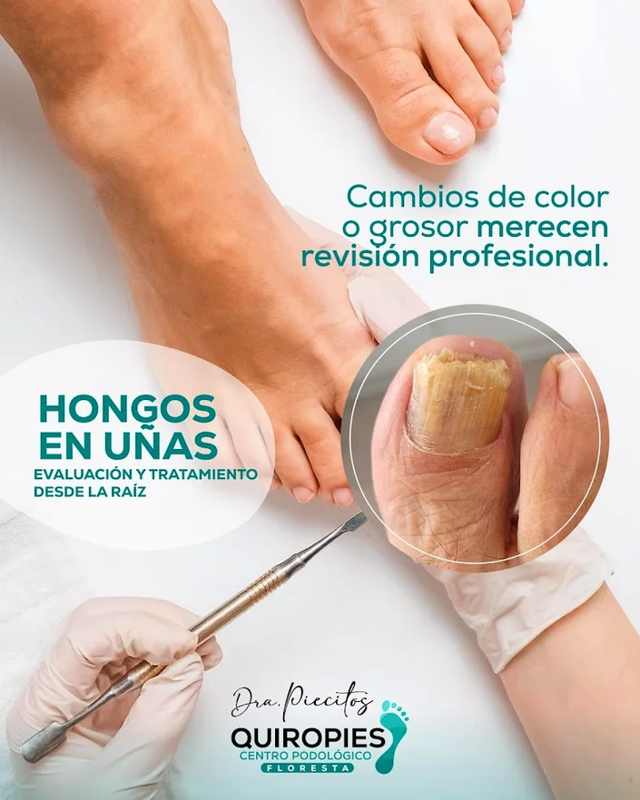 Quiropies Doctora Piecitos